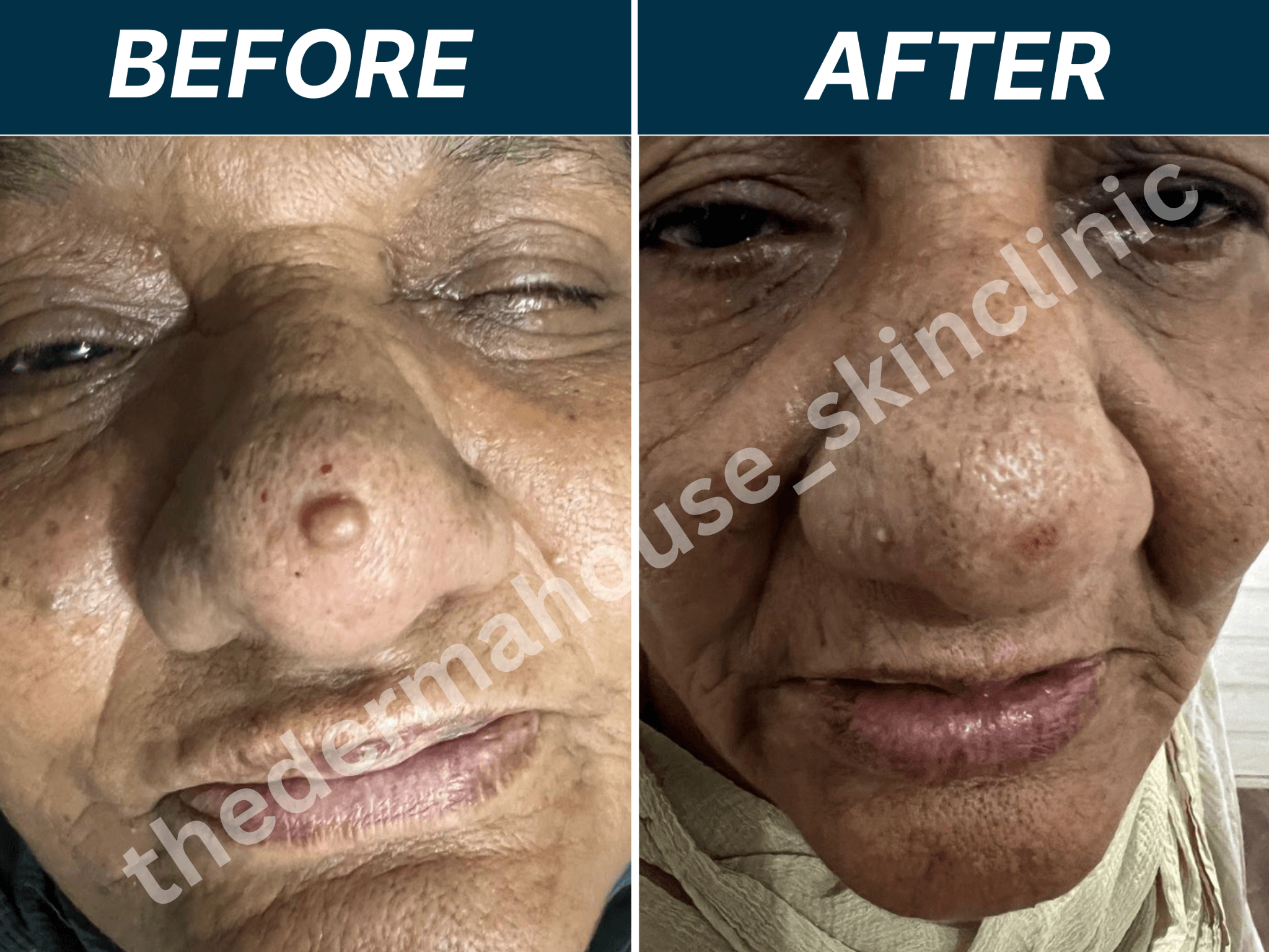 The Derma House , Best Dermatologist in california