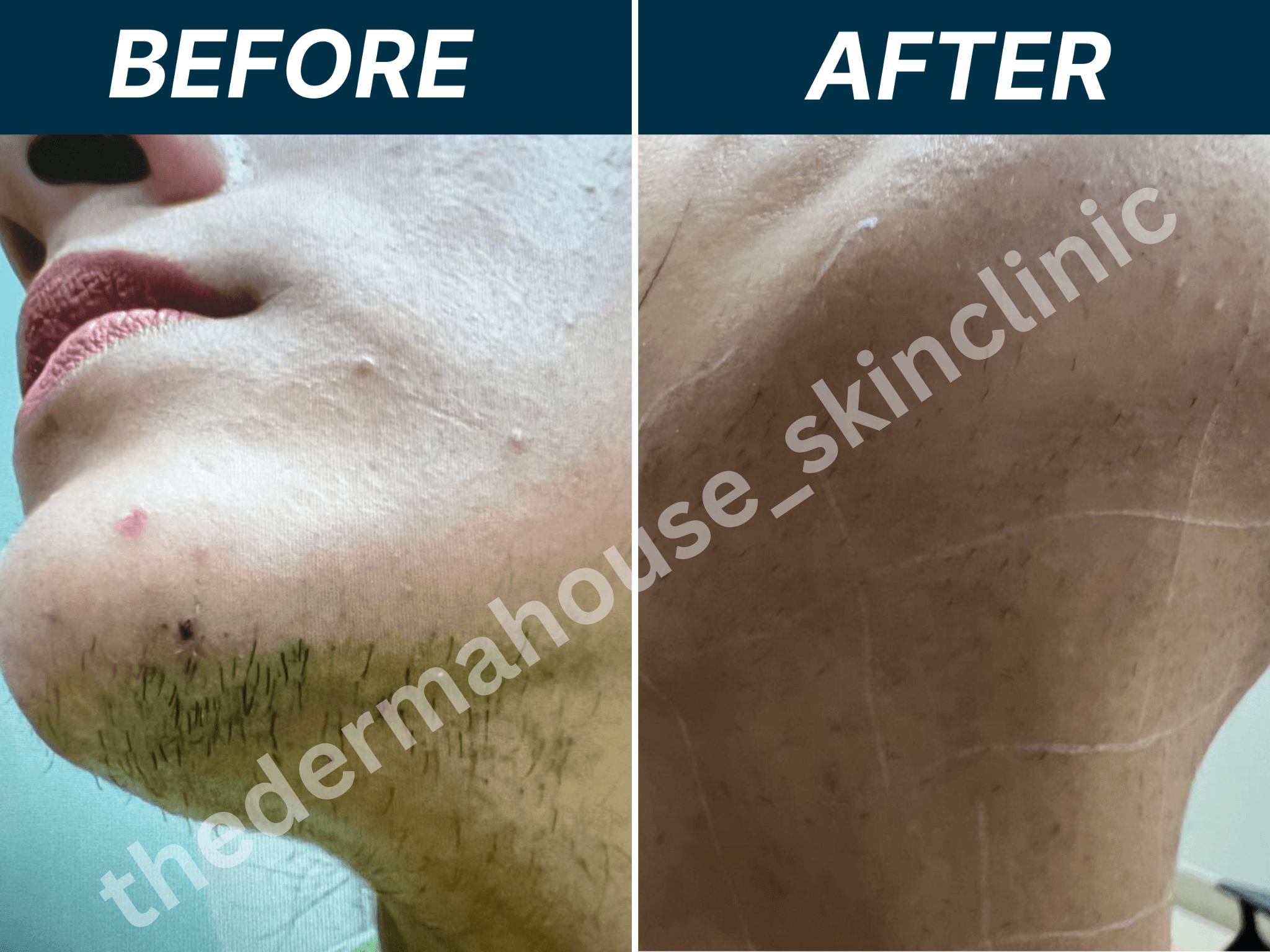 The Derma House , Best Dermatologist in california