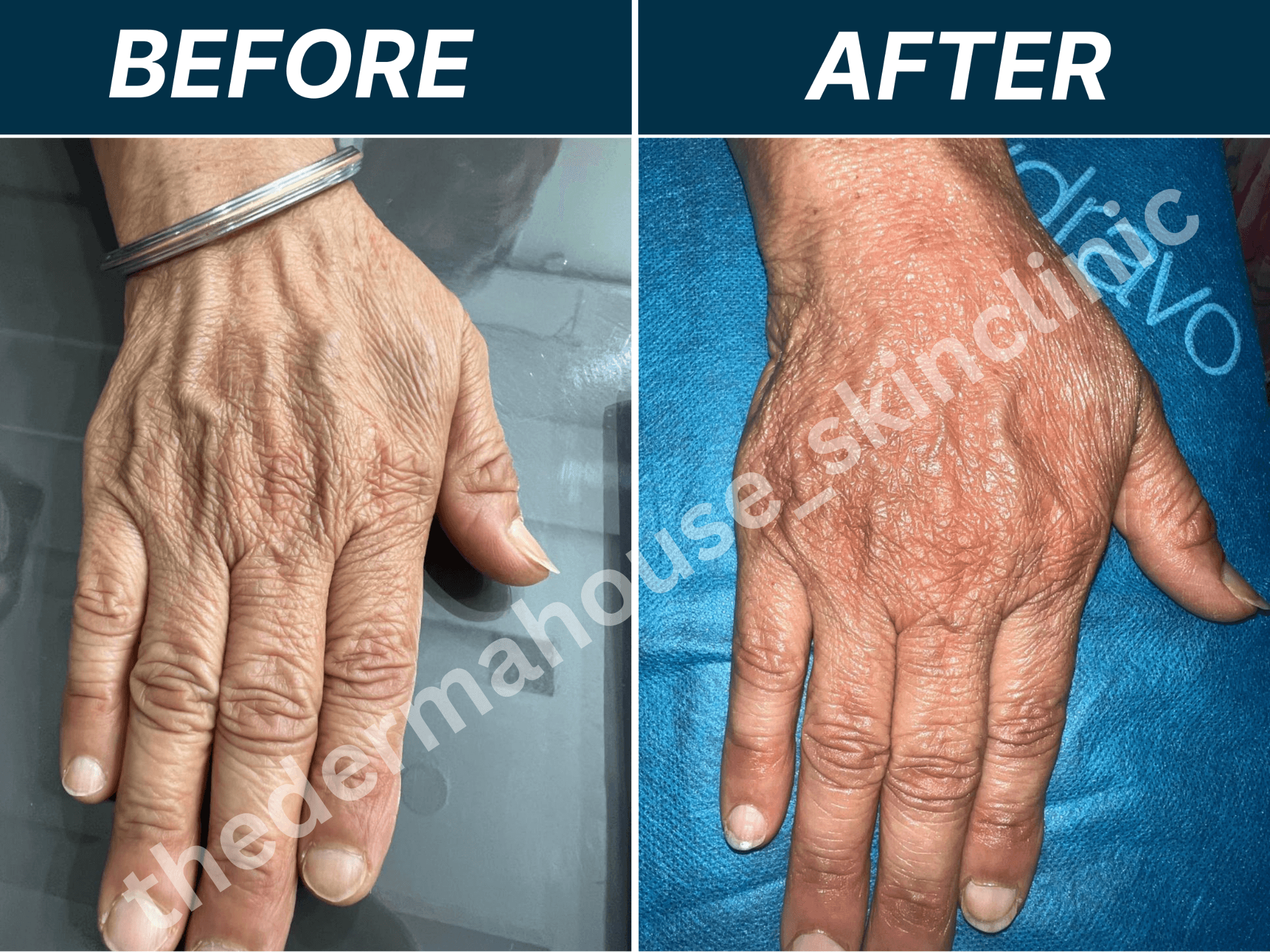 The Derma House , Best Dermatologist in california