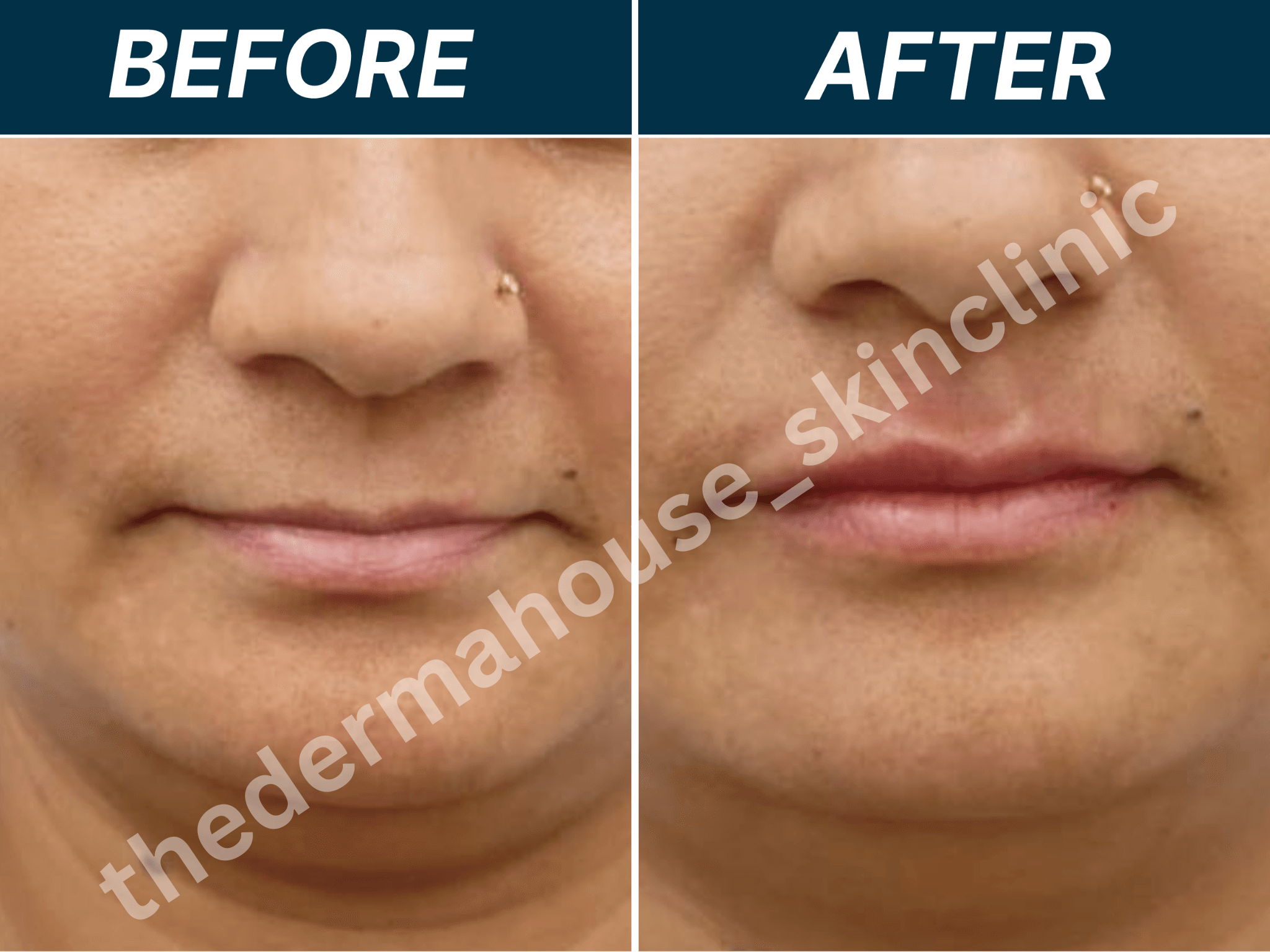 The Derma House , Best Dermatologist in california